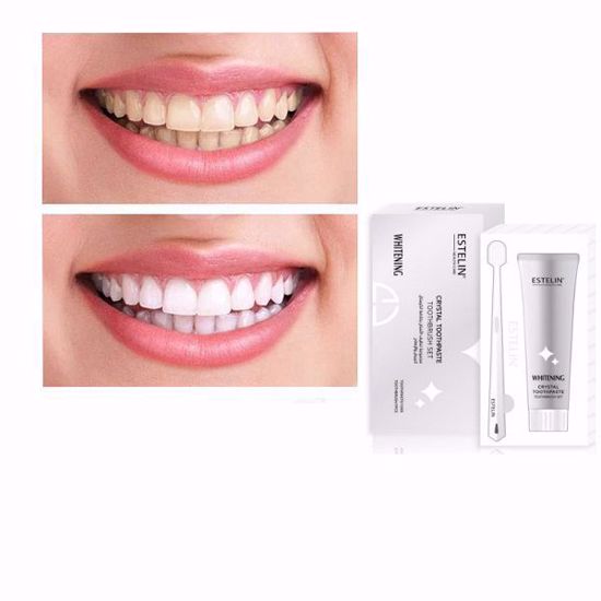 Picture of Estelin Crystal Whitening Toothpaste & Toothbrush Set