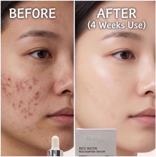 Picture of Dr. Rashel Rice Water & Niacinamide 5% Serum
